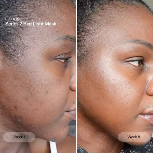 The Skin Rewind - Image 4
