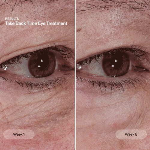 The Skin Rewind - Image 5